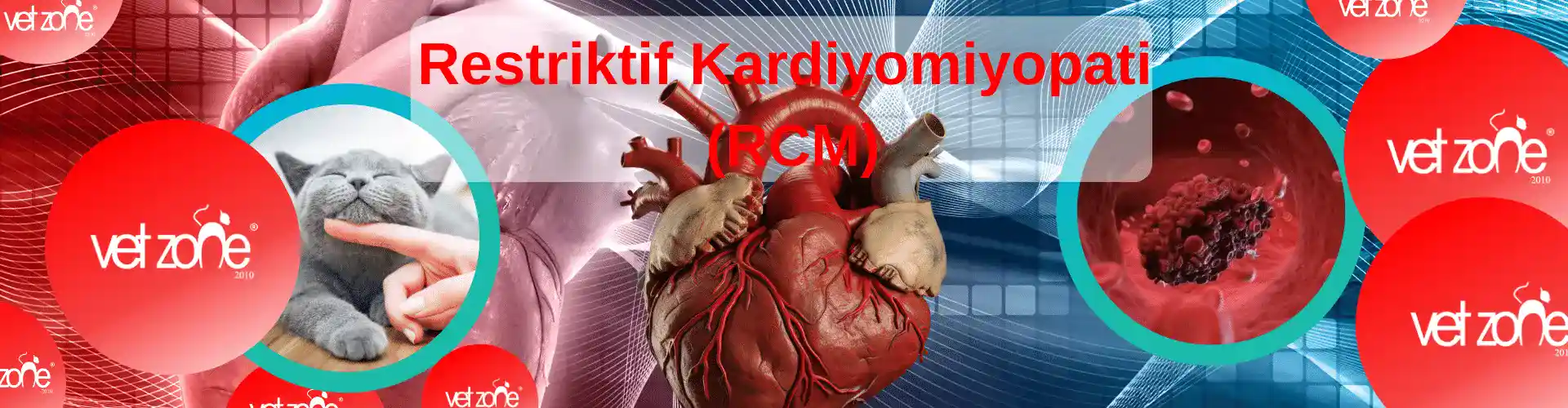 Restriktif Kardiyomiyopati (RCM)