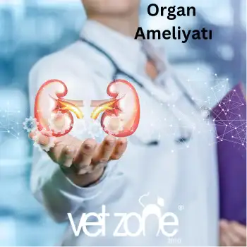 Organ-Ameliyati Organ Ameliyatı